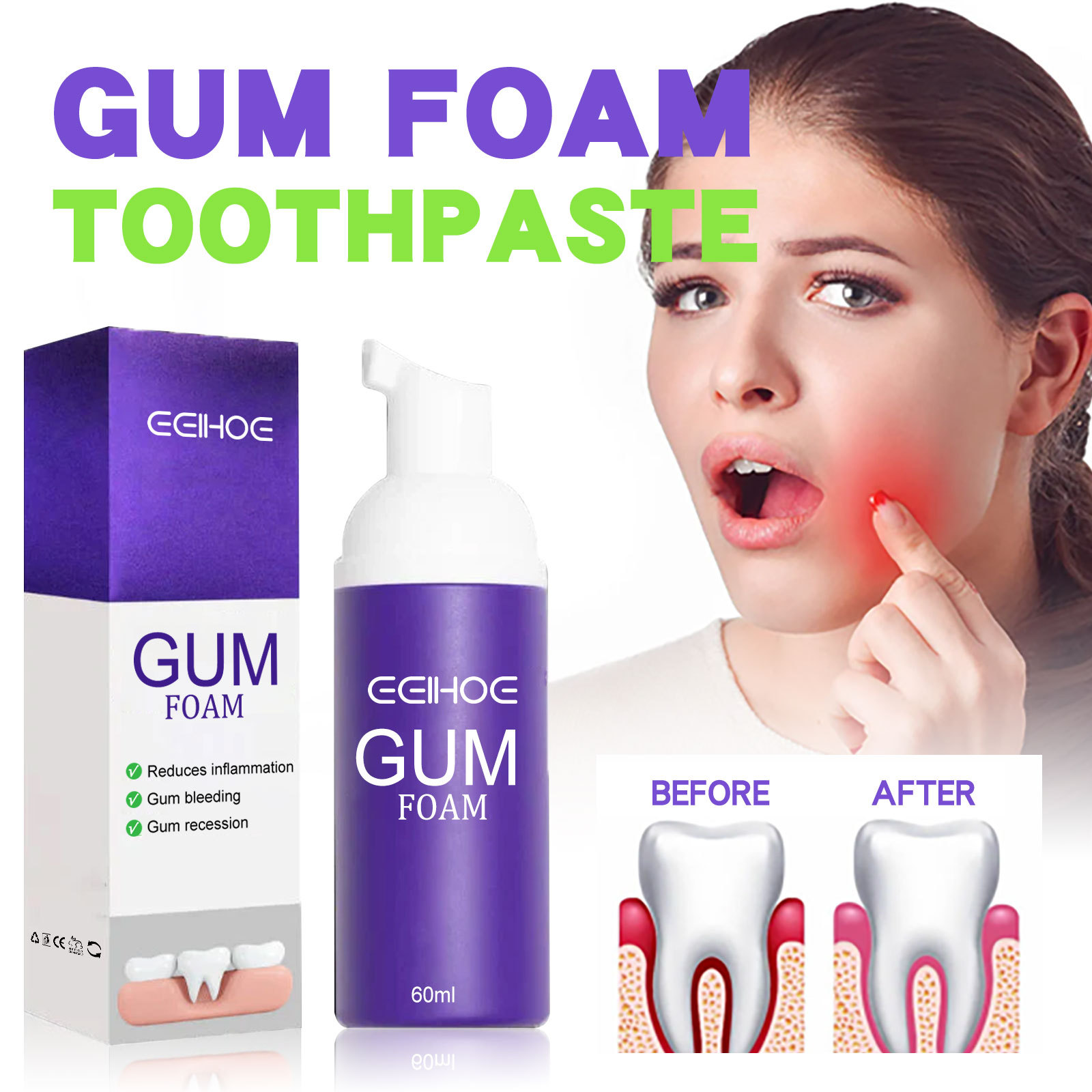 Teeth Whitening Mousse - Mousse de blanchiment des dents V34,
