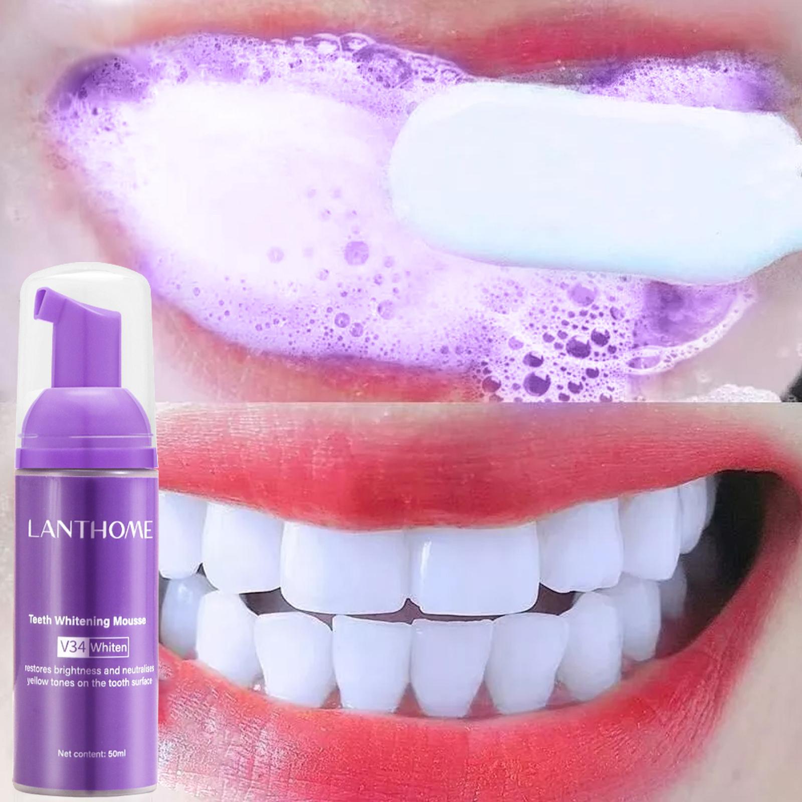 V34 Mousse nettoyage des dents - Teeth Whitening Mousse avis et prix
