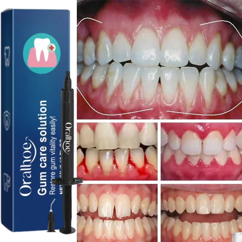 Gel blanchissant pour les dent - Teeth Whitening Gel avis et prix