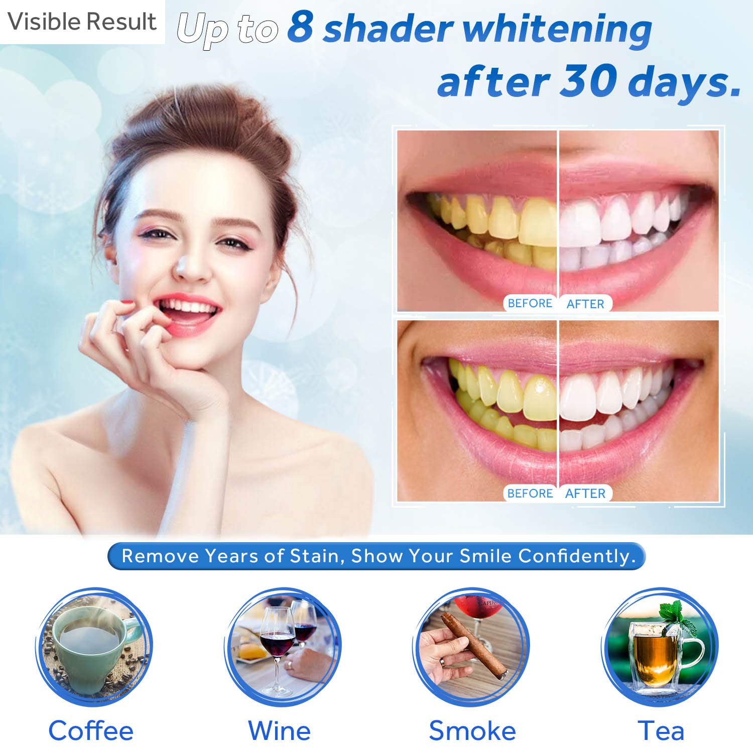 Gel de blanchiment des dents r - Teeth Whitening Gel avis et prix