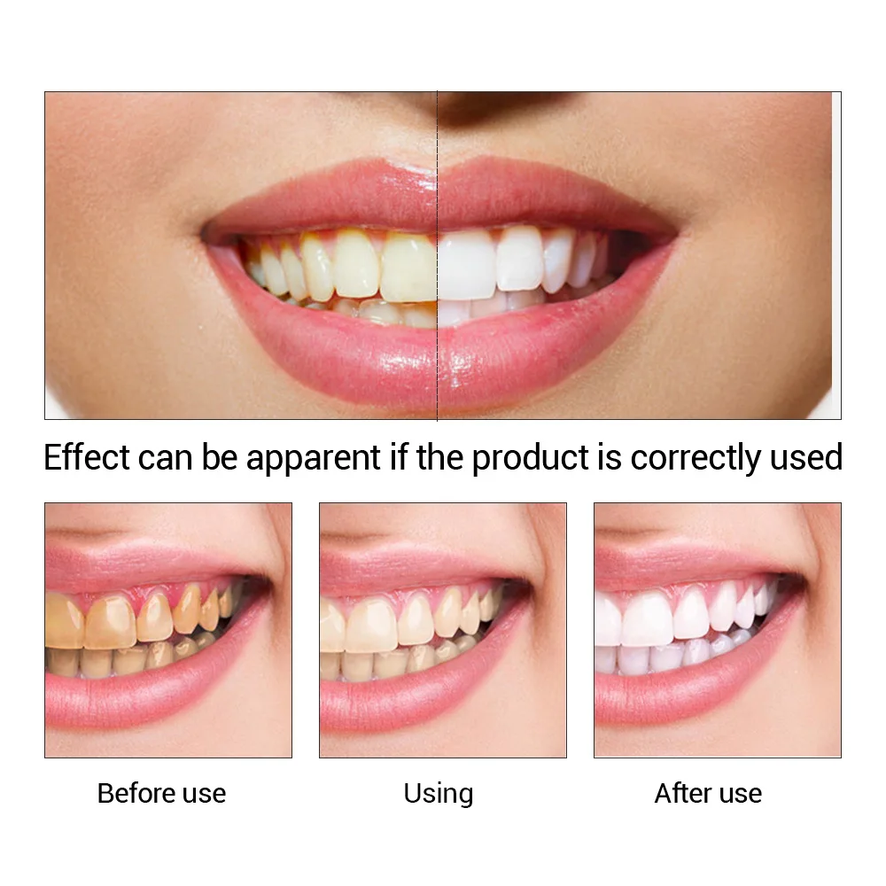 FTEENPLY poudre d'essence de b - Teeth Whitening Levels avis et prix