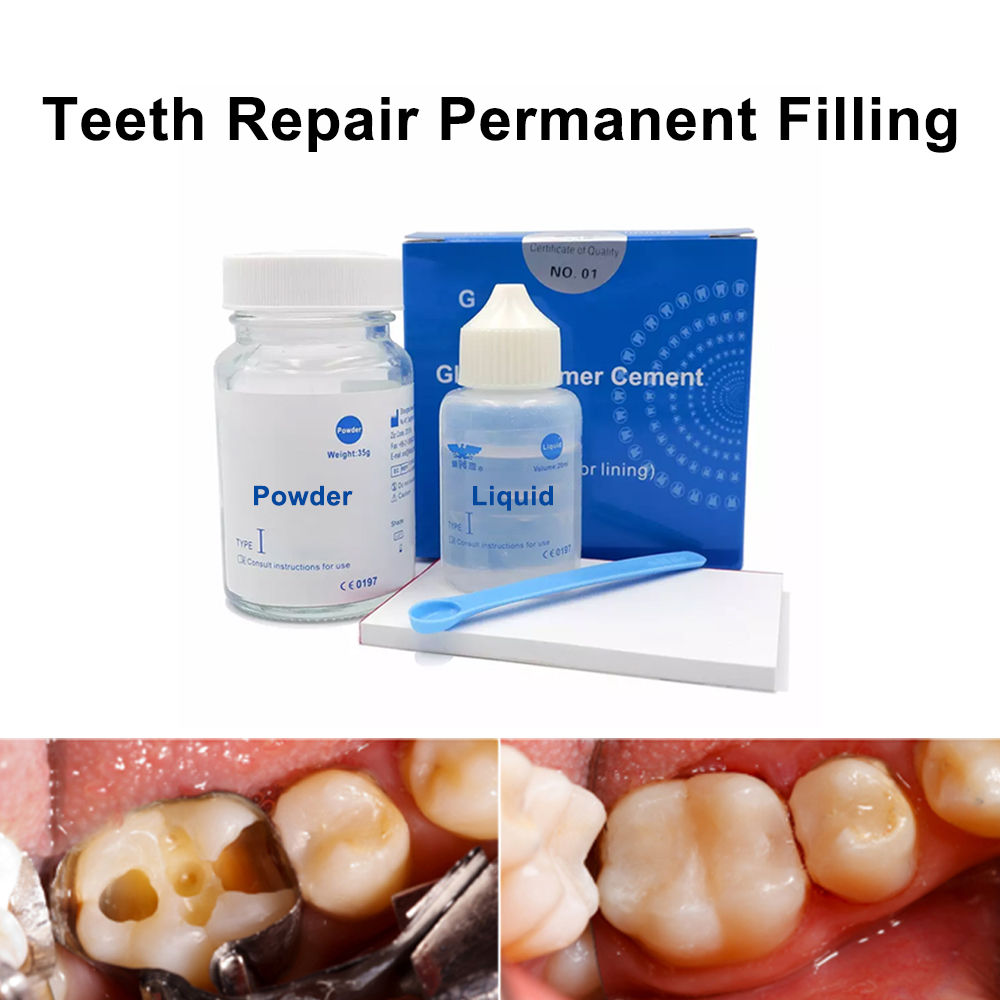 Kit de réparation de remplissa - Teeth Whitening Kit At Home avis et prix