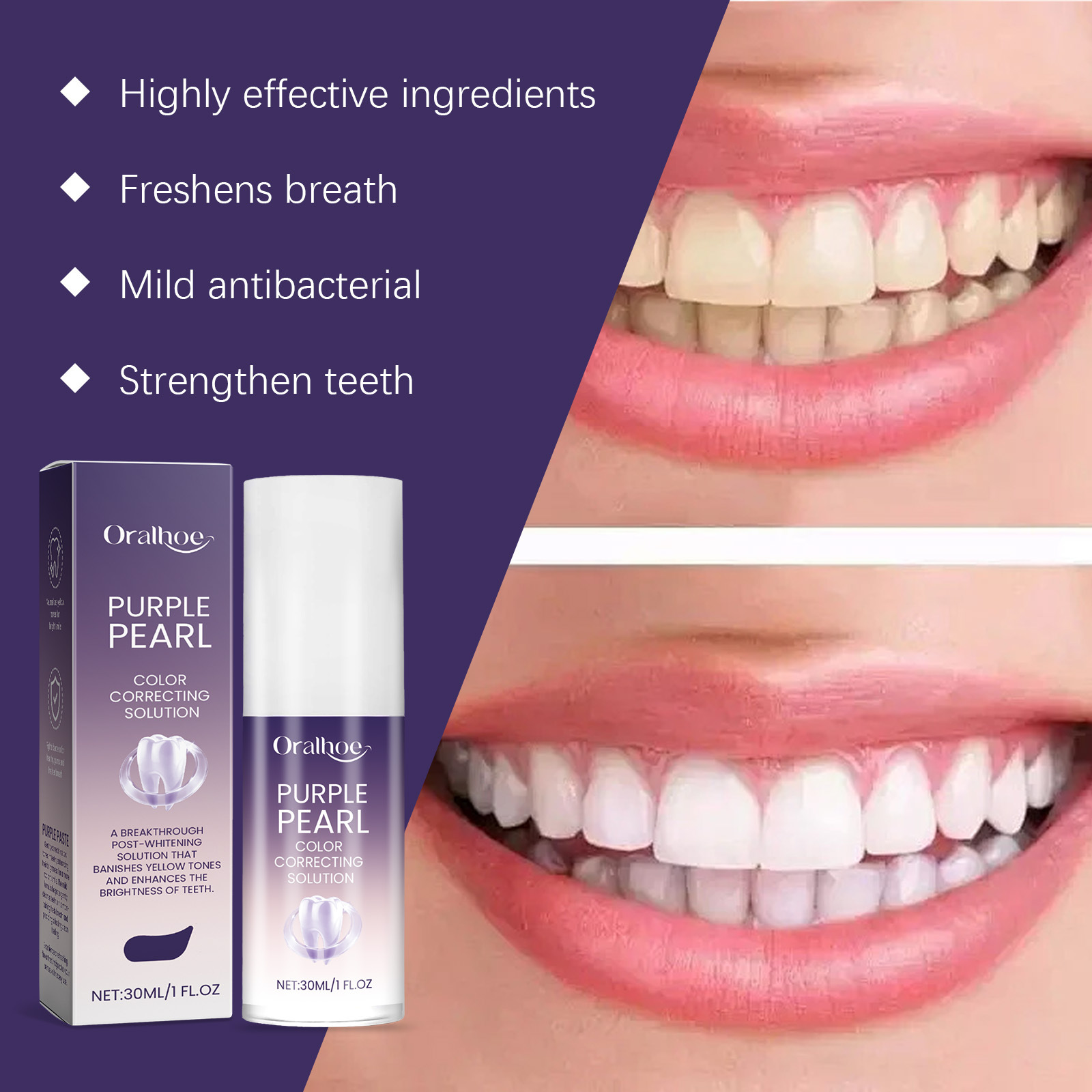 Nouvelle technologie de mousse - Teeth Whitening Mousse avis et prix