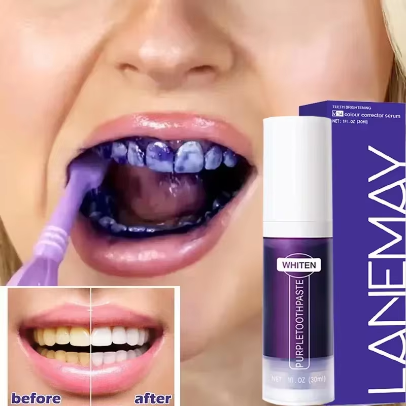 V34 violet blanchiment des den - Teeth Whitening Mousse avis et prix