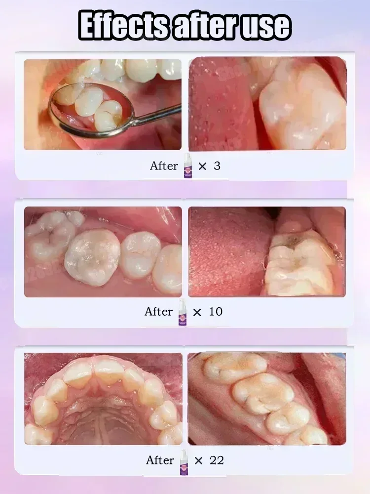 Dentifrice Nettoyant pour les  - Teeth Whitening Cream avis et prix